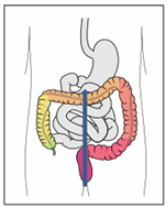 Self-Abdominal Massage 1.png